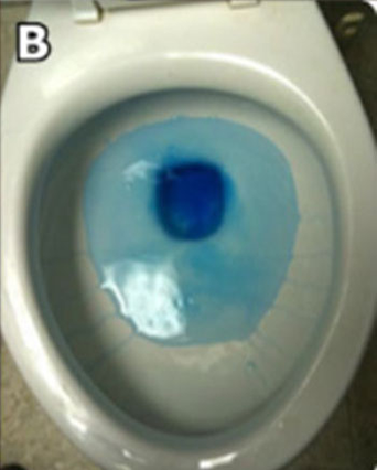 Blue water leak detector in a toilet bowl indicating a toilet tank leak